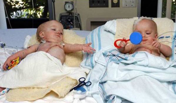 itan-ta-pio-spania-tridyma-ston-kosmo-5