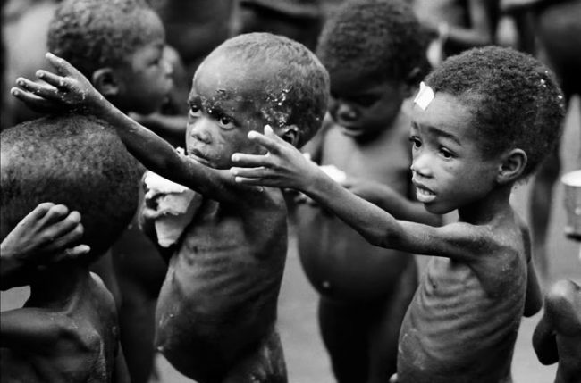 starving-child-5